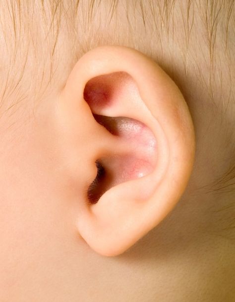 Does your baby need ear tubes surgery? Learn what the procedure is like (from Mom's point of view) and how it helps your little one feel better long-term. Ear Tubes, Easy Art For Kids, Mom Support, Baby Needs, Working Moms, Simple Art, Point Of View, New Baby, Feel Better