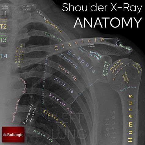 Shoulder Xray Anatomy, Shoulder X Ray Anatomy, Radiology Tech Student, X-ray Tech, X Ray Tech Student, Shoulder Xray, X Ray Anatomy, Xray Anatomy, Radiology Anatomy