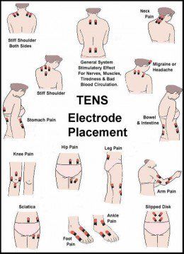 Tens Unit for All Areas of Pain Tens Electrode Placement, Tens Unit Placement, K Tape, Tens Unit, Lev Livet, Ten Unit, Hip Pain, Sciatica, Occupational Therapy