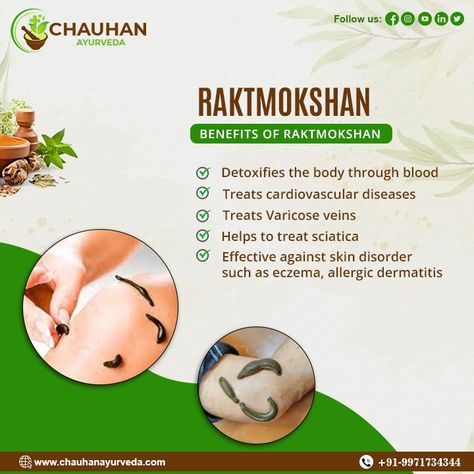 Revitalize your health with Raktmokshan, a specialized Ayurvedic therapy at Chauhan Ayurveda. Experience the ancient wisdom of blood purification for holistic well-being.  Contact us for an appointment: - Email ID: drchauhanayurveda@gmail.com Phone:- +91–9971734344 Website: http://chauhanayurveda.com/  #Raktmokshan #AyurvedicTherapy #BloodPurification #HolisticHealing #AyurvedaTreatment #NaturalTherapy #Detoxification #AncientWisdom #HealthAndWellness #TraditionalMedicine #HealingJourney Ayurveda Hospital, Ayurvedic Therapy, Email Id, Natural Therapy, Traditional Medicine, Ancient Wisdom, Holistic Healing, Healing Journey, Ayurveda