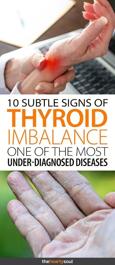 It’s estimated that as many as 25 million Americans have a thyroid problem, and half of them have no idea that they do. Hypothyroidism, or an underactive thyroid, accounts for 90% of all thyroid imbalances. The thyroid, a butterfly-shaped gland in the center of your neck, is the master gland of metabolism. How well your... Thyroid Imbalance, Hashimotos Disease, Thyroid Issues, Thyroid Health, Adrenal Fatigue, Motivation Fitness, Muscle Pain, Health Info, Health Remedies