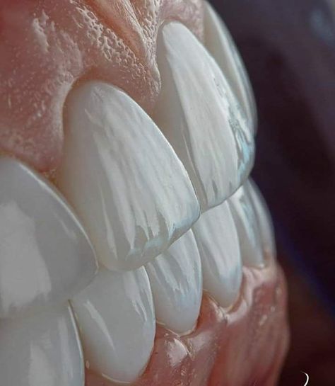 Dental veneers (sometimes called porcelain veneers or dental porcelain laminates) are wafer-thin, custom-made shells of tooth-colored materials designed to cover the front surface of teeth to improve your appearance. These shells are bonded to the front of the teeth changing their color, shape, size, or length Dental Care Aesthetic, Dental Pictures, Esthetic Dentistry, Dental Photos, Dental Images, Dental World, Dental Posters, Dental Aesthetics, Dental Videos