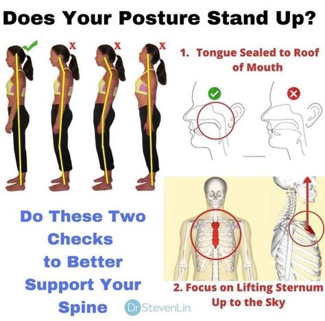 🦷 Dr Seb | Biological Dentist on Instagram: "When you support your posture your blood flow, breathing, and fascial tissues all sit in correct balance. Did you know your tongue actually is a postural muscle? I’ve had both a personal and professional journey into understanding posture. They happened somewhat at the same time. As I began to see how posture issues show up in the mouth, I began to see the same patterns in patients. Forward heads, open mouths, and yep, low tongues, So what did i Tongue Posture, Tongue Muscles, Myofunctional Therapy, Jaw Clenching, Tight Shoulders, Forward Head Posture, Baby Sleep Schedule, Big Muscles, Good Posture