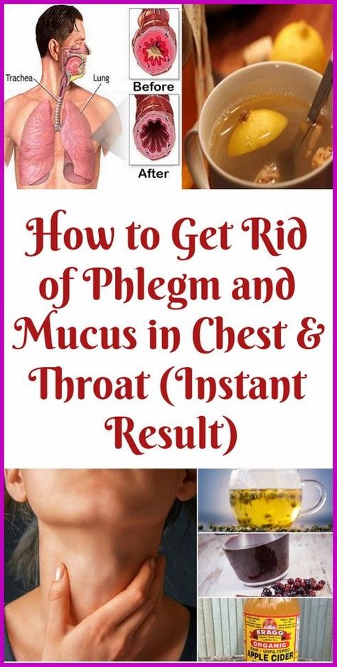 Phlegm In Throat, Mucus In Chest, Mucus In Throat, Getting Rid Of Mucus, Getting Rid Of Phlegm, Home Remedies For Bronchitis, Natural Face Care, Home Medicine, Organic Apple Cider