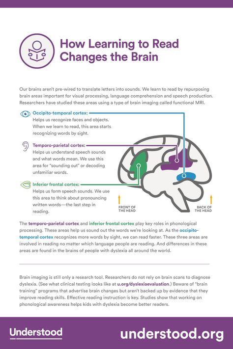 What does reading do to your brain? Use this graphic to learn how reading affects the brain—and how dyslexia and intensive reading instruction affect the brains of struggling readers. Brain Notes, Intensive Reading, Increase Intelligence, Literacy Specialist, Structured Literacy, Learning Disorder, Brain Images, Social Stories Preschool, Brain Learning