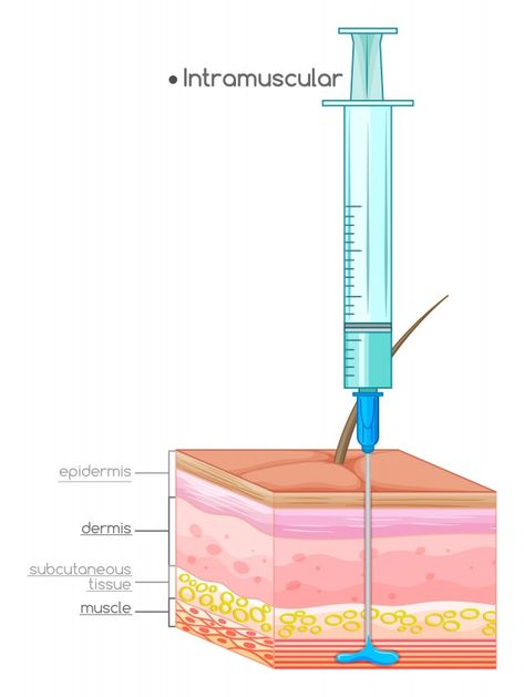 Intramuscular Injection Sites, Injection Sites, Subcutaneous Tissue, Facial Aesthetics, Diagram Design, Premium Vector