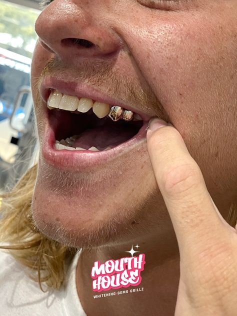 grillz, grillz teeth, grillz teeth men, grillz women, grillz aesthetic, grills, grills for women, grills for men, solid gold grills, grills window design, grills teeth female, 10k grillz, 10k grills, iced out grills, iced out teeth, icyteeth, 90s aesthetic, hip hop aesthetic, hip hop style, hip hop frillz, gangsta girl, girly things, mens jewellery, mens gold chains, mens cuban chains, iced out jewellery, iced out chains, iced out grills, iced out grillz Gold Teeth Men, 90s Aesthetic Hip Hop, Aesthetic Grills, Women Grills, Grillz Women, Men Grillz, Grillz Teeth Men, Grills For Women, Grillz Aesthetic