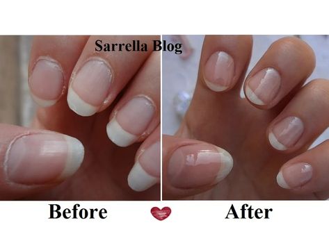 How to Do the Perfect Manicure at Home : 23 Steps (with Pictures) - Instructables Perfect Manicure At Home, Gel Manicure Designs, Diy Gel Manicure, Manicure Steps, Cuticle Softener, Hand And Foot Care, Perfect Health, Nail Soak, Perfect Manicure