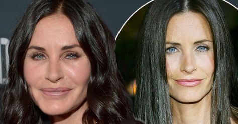 The Friends star admits to using Botox to keep her youthful good looks but says she wouldn't have surgery as her fiance hates the idea Courtney Cox Plastic Surgery, Bad Plastic Surgeries, Cosmetic Fillers, Plastic Surgery Fail, Face Fillers, Botox Before And After, Facial Fillers, Courtney Cox, Made A Mistake