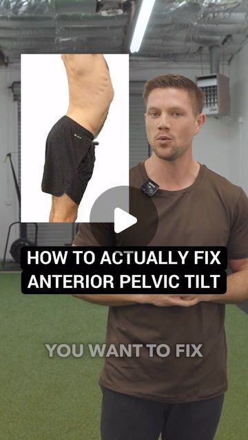 Conor Harris on Instagram: "Did you know there are two different ways you can be in Anterior Pelvic Tilt? Each has its own best fix ✅  Before the Anterior Pelvic Tilt police arrive: There is nothing wrong inherently with APT and I do think that’s important to appreciate. However, it CAN represent certain movement limitations I discuss and this, over time, can lead to undesired wearing of some tissues and joints. Also there is nothing wrong with wanting to improve the visual appearance of one’s posture. —— #posture #posturecorrection #posturematters #posturetips #goodposture #lowbackpain #backpain #backpainrelief" Fixing Pelvic Tilt, Anterior Vs Posterior Pelvic Tilt, Pelvic Tilt Correction Exercise, Tilted Pelvis Exercises, Anterior Pelvic Tilt Correction, Pelvic Tilt Correction, Anterior Pelvic Tilt, Pelvic Tilt, Hip Mobility