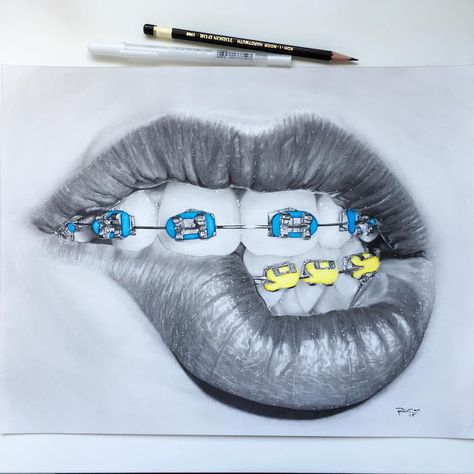 All done!!! I doubt I'll be doing another braces drawing anytime soon! Hope you like! Braces Drawing, Dentist Art, Lips Art Print, Cute Braces, Teeth Art, Brace Face, Tree Drawings Pencil, Mouth Drawing, Graphisches Design