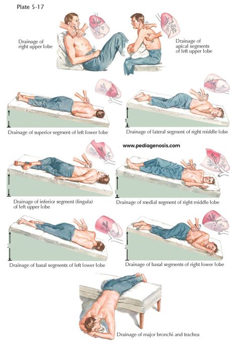 Respiratory Physiotherapy, Postural Drainage, Physiotherapy Student, Breathing Apparatus, Thai Yoga Massage, Nurse Study Notes, Cramps Relief, Nursing School Survival, Chronic Obstructive Pulmonary Disease