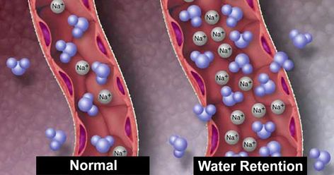 Period Cramp, Most Nutritious Vegetables, Reduce Water Retention, Puffy Face, Water Retention Remedies, About To Pop, Swollen Ankles, Detox Plan, Fluid Retention