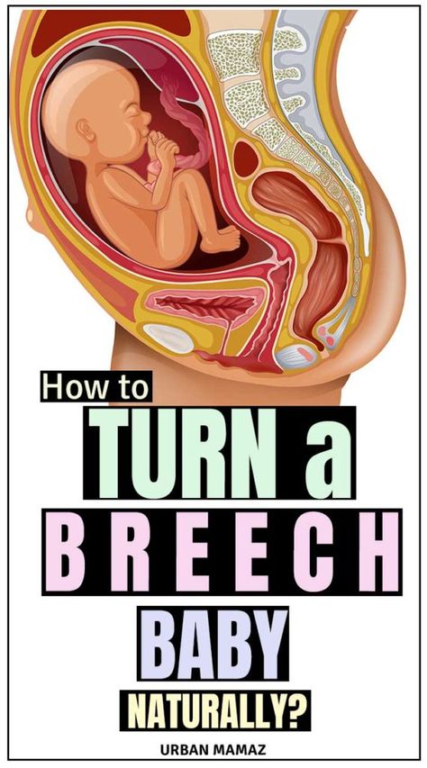 Is your baby in a breech position? Check out these natural ways to turn your breech baby to the right position - Cephalic position! Ways to turn your breech baby naturally- click here》》》 #breechbaby #breechbirth #pregnancy #pregnancytips Breech Baby Exercises, Turn A Breech Baby, Breech Birth, Breech Baby, Breech Babies, Pregnancy Checklist, Baby Workout, Pregnancy Labor, Baby Yoga