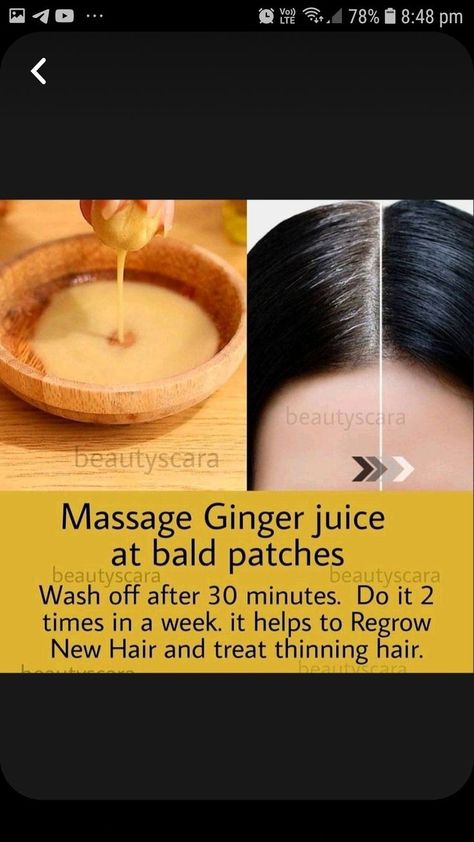 Ginger For Hair Growth, Ginger For Hair, Treat Thinning Hair, Homemade Hair Treatments, Thick Hair Remedies, Hair Care Remedies, Natural Skin Care Remedies, Hair Growing Tips, Healthy Advice