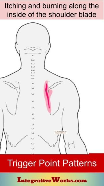 Pain Between Shoulder Blades: Pain Patterns, Causes, Self-Care | Integrative Works Shoulder Trigger Points, Shoulder Blade Stretch, Shoulder Blade Pain, Sore Neck And Shoulders, Neuromuscular Therapy, Sore Shoulder, Thoracic Vertebrae, Shoulder Stretches, Sore Neck