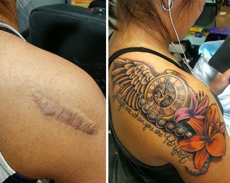 10+ Amazing Tattoos That Turn Scars Into Works Of Art Tattoo Over Scar, Scar Cover Up, Tattoos To Cover Scars, Scar Tattoo, Omerta Tattoo, Magic Tattoo, Black Girls With Tattoos, Stylist Tattoos, Tattoo Cover-up