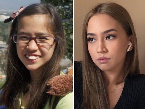 25 Ugly Ducklings Who Had a Glow-Up. Ugly Noses Women, Ugly To Pretty Transformation, Ugly Smiles, Ugly Side Profiles, Ugly Noses, Decent Hairstyle, Neck Beard, Pretty Ugly, Bushy Eyebrows