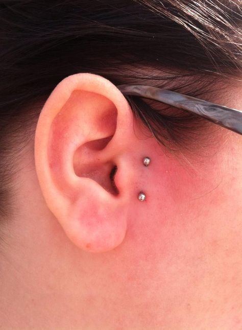 my new piercing it didnt hurt at all! Ear Surface Piercing, Surface Piercing Ear, Surface Tragus Piercing, Surface Tragus, Dermal Piercings, Skin Piercing, Dr Claims, Surface Piercing, New Piercing