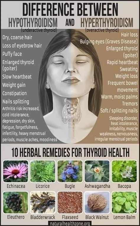 Enlarged Thyroid, Overactive Thyroid, Thyroid Symptoms, Graves Disease, Thyroid Issues, Thyroid Function, Thyroid Health, Fajitas, الرسومات اللطيفة