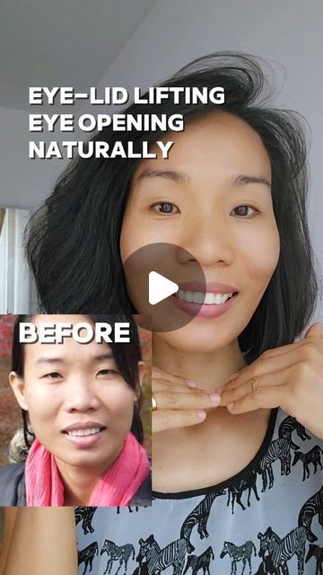 Face Yoga Before And After, Slimmer Face, Eye Exercises, Face Exercises, Facial Exercises, Face Yoga, After Photos, Core Workout, My Eyes