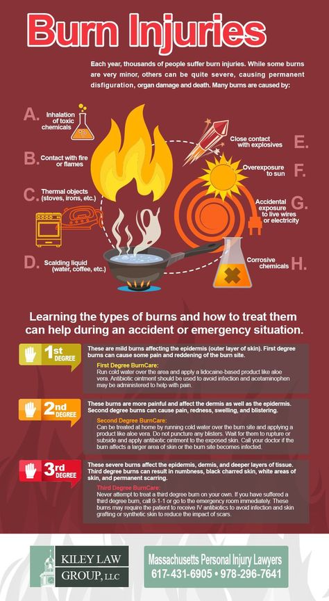 Information on different types burn injuries Types Of Burns, Treat Burns, Burn Injury, First Aid Tips, Degree Burns, Nursing School Notes, Emergency Preparation, Emergency Prepping, Medical Knowledge