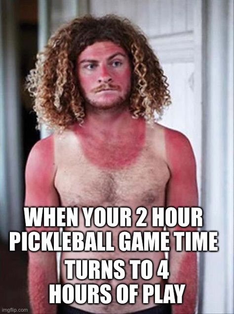 Sunburn Sunburn Meme, Pickleball Drills, Pickle Balls, Pickleball Quotes, Pickleball Gift, I Lose, Peeling Skin, Game Time, Pickleball