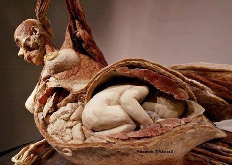 Diseccion Gunther Von Hagens, Medical Things, Bizarre Art, Body Fluid, After Life, Anatomy And Physiology, Anatomy Art, Human Anatomy, Body Health