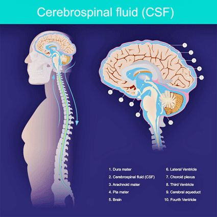 Intracranial Pressure, Sensory Nerves, Spinal Fluid, Spinal Nerve, Cerebrospinal Fluid, Fatigue Syndrome, Chronic Disease, Chronic Fatigue, Neck Pain