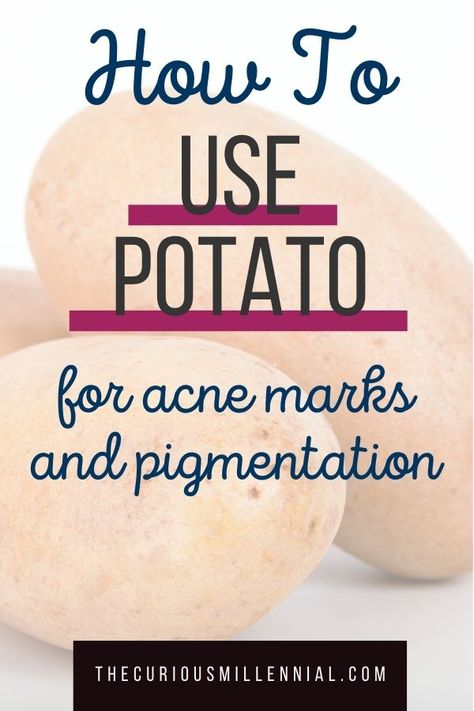 Potato For Acne, Potato Juice For Skin, Potato For Skin, Potato Face Mask, Potato Face, Acne Scar Mask, Mask For Acne, Potato Juice, Mask Recipes