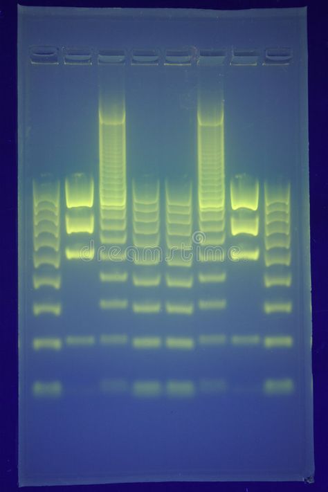 DNA separation. DNA fragments separated by agarose gel electrophoresis , #sponsored, #fragments, #separated, #DNA, #separation, #electrophoresis #ad Genetic Research Aesthetic, Genetic Aesthetic, Biotechnology Aesthetic, Molecular Biology And Genetics Wallpaper, Dna Gel Electrophoresis, Dna Repair Enzyme, Aesthetic Science, Gel Electrophoresis, Speculative Design