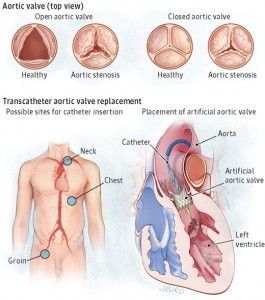 Cardiac Physiologist, Nursing Binder, Cardiovascular Technology, Nightingale Pledge, Cath Lab Nursing, Aortic Valve Replacement, Cardiothoracic Surgery, Cardiac Cycle, Interventional Cardiology