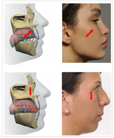 Punkty Spustowe, Jaw Exercises, Jawline Exercise, Myofunctional Therapy, Facial Bones, Face Anatomy, Facial Aesthetics, Tongue Health, Face Exercises