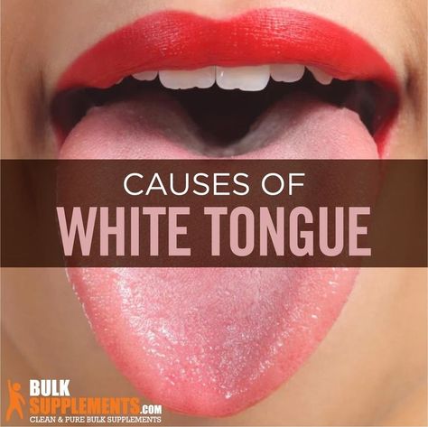 White Tongue Remedy, Tongue Color Meaning, White Tongue Causes, Tongue Thrust, Candida Yeast Infection, Garlic Supplements, White Tongue, Tongue Health, Japanese Mom