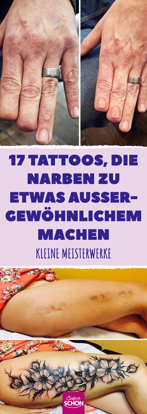 17 Tattoos, die Narben zu etwas Außergewöhnlichem machen #kuriositäten #tattoos #narben #cover-up Curiosity Tattoo, Mujeres Tattoo, Cute Tattoos On Wrist, Creme Anti Age, Cat Tattoos, Disney Tattoo, Small Wrist Tattoos, Tree Of Life Tattoo, Tiny Tattoo