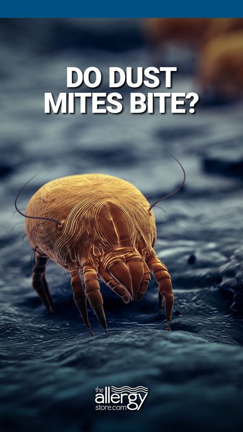 People frequently ask if dust mites bite. They have skin problems associated with their allergies (such as allergic urticaria) and assume that these hives are bites. Dust Mites Bites, Allergy Hives, Dust Mites, Skin Problems, The Question, Allergies, Skin