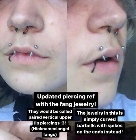 Inverse Vertical Labret, Angel Fangs, Angel Bites Piercing, Angel Bites, Upper Lip Piercing, Snake Bite Piercing, Philtrum Piercing, Mouth Piercings, Vertical Labret