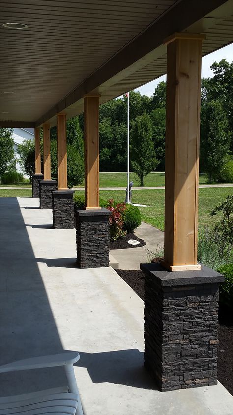 Front Porch Columns, Faux Stone Siding, Porch Remodel, House Front Porch, Porch Columns, Porch Posts, Front Porch Design, Porch Makeover, Stone Siding