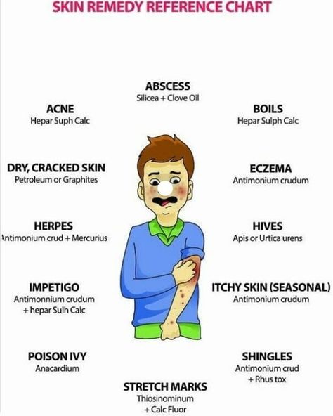 LOVE FOR MEDICAL & HOMOEOPATHY (@stunning_homoeopathy) • Instagram photos and videos Impetigo Remedies, Remedies For Skin, Homeopathy Remedies, Homeopathy Medicine, Acne Oil, Homeopathic Medicine, Cracked Skin, Skin Remedies, Homeopathic Remedies