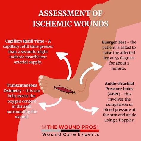 In the absence of adequate blood supply, wound healing stages experience delayed progression which leads to the development of ischemic tissues in chronic wounds. 6.5 million people in the United States suffer from Peripheral Arterial Disease which is associated with the presence of chronic, ischemic wounds. Learn more about Effective Wound Management For Ischemic Wounds in our blog: https://www.thewoundpros.com/post/effective-wound-management-for-ischemic-wounds Wound Care, Wound Healing, Blood Pressure, Disease, Healing