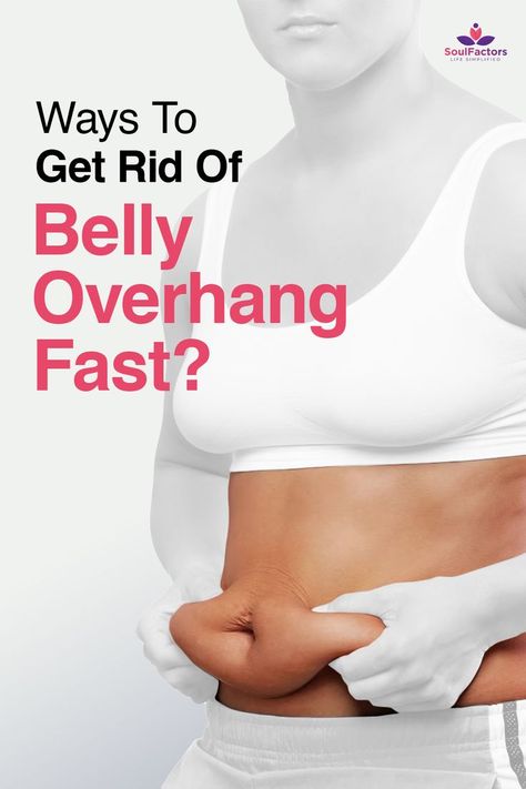 How To Get Rid of Belly Overhang Fast? Overhang Belly, Flabby Stomach, Rid Belly Fat, Flabby Belly, Hanging Belly, Lose Tummy Fat, Stomach Fat, Your Best Self, How Do I Get