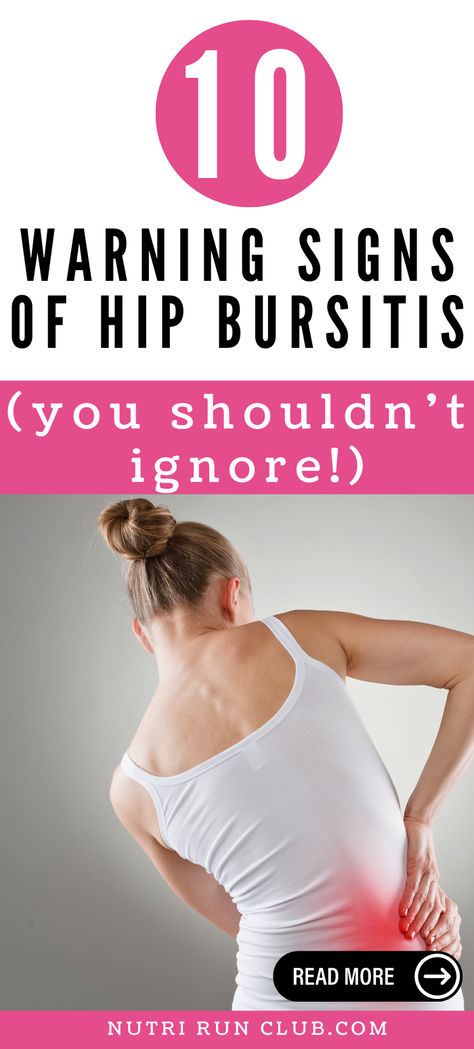 We bring you the Ultimate Guide with the Best Tips for Dealing with Bursitis Hip! Discover what bursitis in the hip is, its causes, symptoms, and diagnosis. Learn effective management strategies for hip joint inflammation in our comprehensive guide. Don't let hip pain hold you back! We got you. Read more: exercises for bursitis in hip, bursitis hip symptoms, bursitis in hip, bursitis hip stretching, how to treat bursitis in the hip, bursitis of hip, bursitis hip cause, bursitis in the hip... What Is Bursitis Hip Pain, Hip Exercises For Women For Pain, Bursitis Hip Relief, Hip Pain Causes, Effective Management, Bursitis Hip, Body Inflammation, Runners Knee, Hip Pain Relief