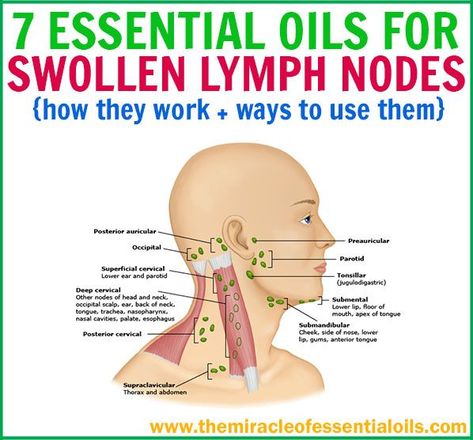 Oils For Colds, Lymph Glands, Lymph Node, Vegan Probiotics, Essential Oils For Colds, Drainage Massage, Lymph Massage, Lymph System, Essential Oils For Pain