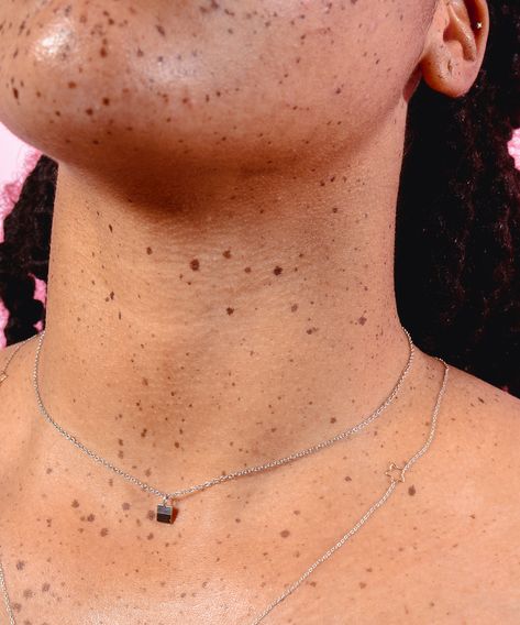 Beautiful Freckles, Natural Glowy Makeup, Lighter Skin, Acne Marks, Glowy Makeup, Modern Love, Viral Trend, Light Skin, Aging Skin