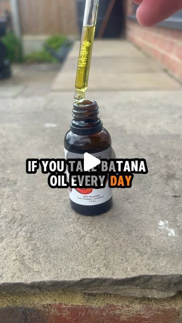 Health school on Instagram: "What happens to your hair if you take batana oil everyday   Follow @realhealthschool to optimise your health ⚡️  Save for later 🌿  #health #healthpost #healthfacts #healthychoices #healthyfruits #fruits #fruitsbenefits #pineapple #healthy #fatloss #bellyfatloss #weightloss #facts #fyp #viral" Batana Oil Before And After, Batana Oil Benefits, Batana Oil, Health Post, Fruit Benefits, Growth Tips, Oil Benefits, Hair Growth Tips, Save For Later