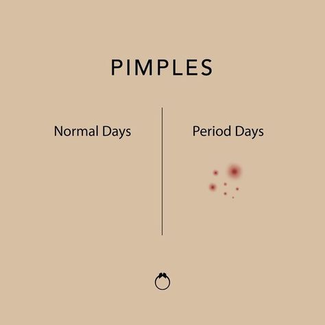 Pimples Pimples Quotes, Period Pimples, Period Pads, Panty Liner, Sanitary Pads, Hormonal Changes, Cotton Pads, Girly Photography, Care Routine