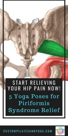 Piriformis Exercises, Piriformis Syndrome Exercises, Hip Flexor Exercises, Piriformis Muscle, Piriformis Stretch, Hip Exercises, Hip Pain Relief, Piriformis Syndrome, Sciatica Exercises