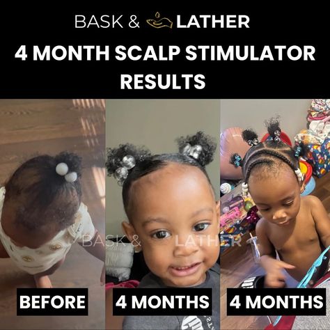 4 months before using our hair growth products, this baby girl was struggling to grow her hair. Her mother felt helpless but Bask and Lather came through 💛🙌🏾 . . . . #hairtransformations #kidshairstyles #beforeandafterhair #hairoftheweek #haircare #baskandlatherco Grow Baby Hair, Baby Hair Growth, 5 Month Baby, Hair Growth Products, Growth Oil, 4c Hairstyles, Hair Growth Oil, Toddler Hair, 4 Months