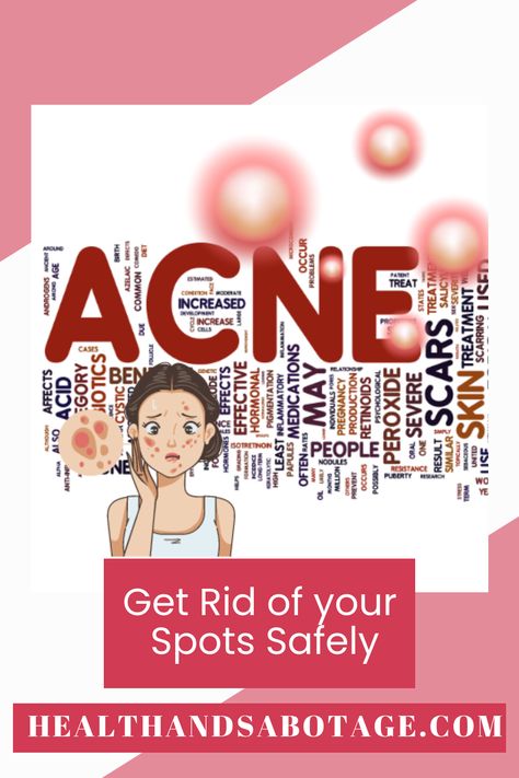 Are spots ruining your outfit and photo opportunities? Do you decide not to go out because you have huge pustules accenting your cheekbones? We have the solution for you and yes, it does include a good cleansing routine and something else which is so easy to do, you will wonder why you hadn't thought of it yourself! Check out my post and give it a go, you can't fail, just continue and you will have beautiful clear skin again. Get Rid Of Pimples, Rid Of Pimples, Cleansing Routine, How To Get Rid Of Pimples, Scarring, Leave Behind, Clear Skin, Psychology, Health And Beauty