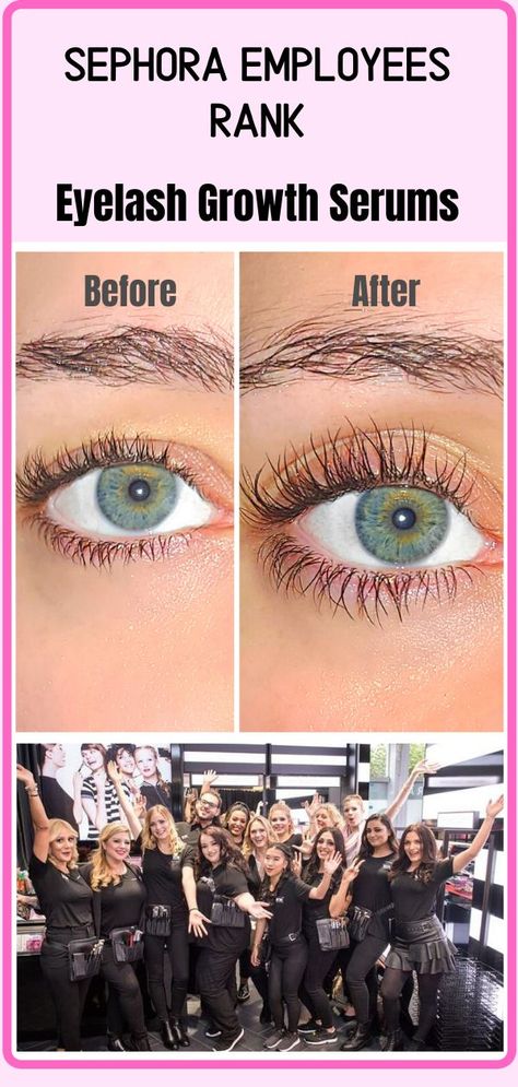 Long Natural Eyelashes, Eyelash Growth Vaseline, Eyelash Serum Diy, Latisse Eyelashes, Eyelash Growth Cycle, Grande Lash Serum, Eyelash Growth Diy, Eyelash Serums, Best Lash Serum